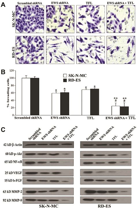 Decreases In Cell Migration Survival Angiogenesis And Invasion In