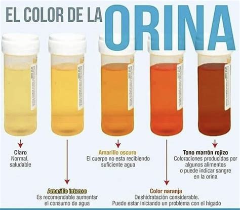 Qué Color Es La Orina Cuando Hay Infección Yewer