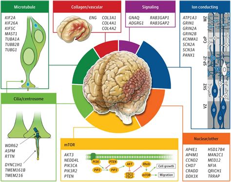 New Genetic Variants Linked To Brain Malformation