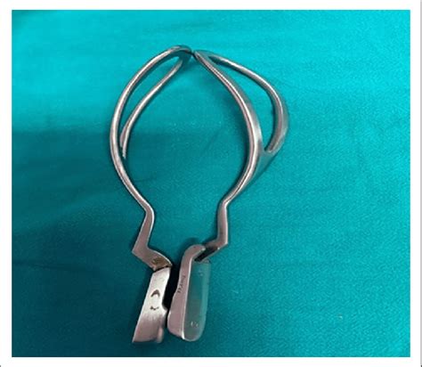 The Wrigleys Obstetrical Forceps That Was Used For Calculus Extraction