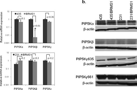 Figure 42 From The Role Of Phosphoinositide Signaling In Breast Cancer