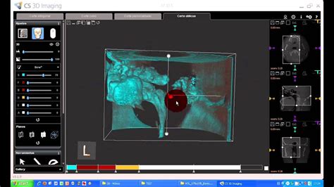 Tutorial Cs D Imaging Software Carestream Ajustes D Para Vias