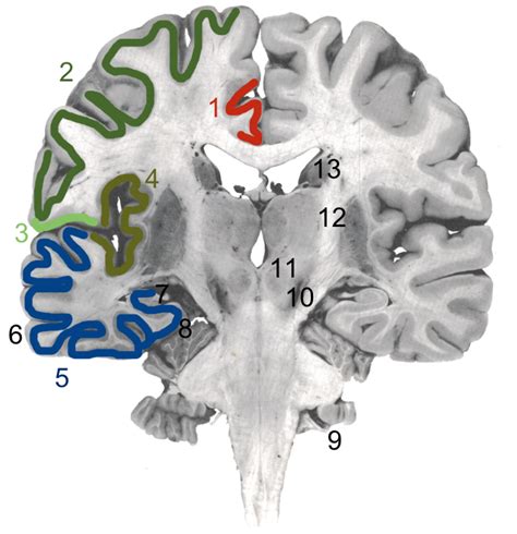 Le système limbique Neuromedia