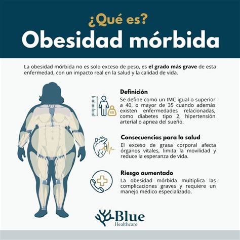 O Que Significa A Palavra Mórbida - Obesidad mórbida: el primer paso hacia una vida más saludable