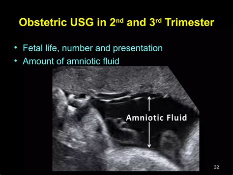 Obstetric ultrasound | PPT