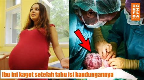 Ajaib Semua Orang Kaget Melihat Isi Kandungan Ibu Ini YouTube