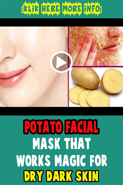 Potato Facial Mask That Works Magic For Dry Dark Skin Viralhotss