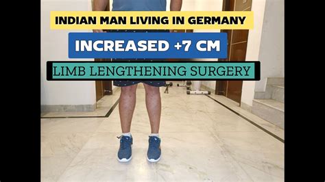 Patient S Experience After Limb Lengthening Surgery Leg Lengthening