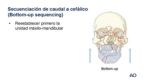 Fracturas Panfaciales Secuenciacin De La Reparacin Presenters Name