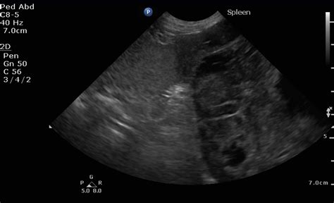 What Are The Symptoms Of Spleen Cancer In Dogs