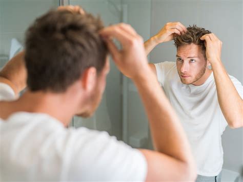 Psoriasis En El Cuero Cabelludo Estas Son Sus Causas Y S Ntomas