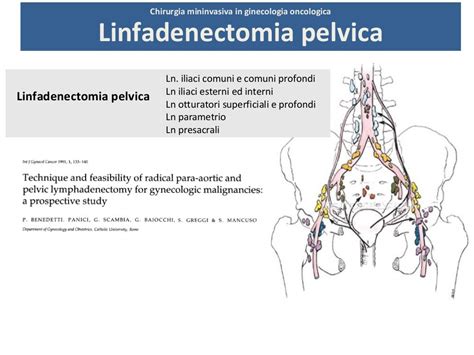 Chirurgia Mininvasiva In Ginecologia Oncologica Linfadenectomia Intr