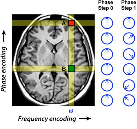 Phase Encoding Questions And Answers In Mri