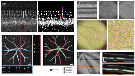 Bioengineering Free Full Text Optical Coherence Tomography Is A