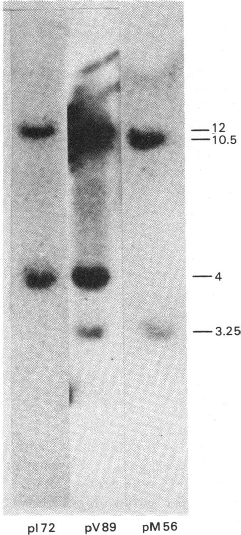 Southern Blot Hybridization Showing Ecori Fragments Of Chick Genomic Download Scientific