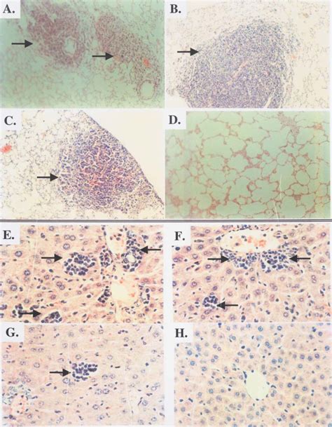 Zyd Inhibited Tumor Metastasis To The Lung Panels A D And Liver