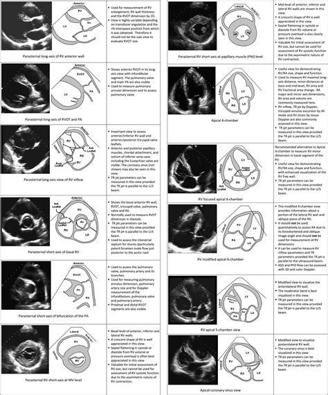 Guidelines For The Echocardiographic Assessment Of The Right Heart In