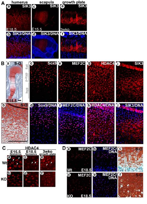 Expression Patterns Of Sik And Chondrocyte Hypertrophic Factors