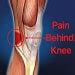 5 Pain Behind Knee Causes with Relief Tips - Pro Knee Pain Relief