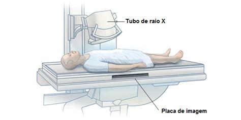 Radia Es E Seu Uso Na Medicina Energia Nuclear