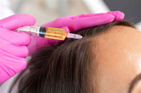 Prp Injections For Hair Loss A Comprehensive Guide H Shot