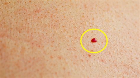 What Causes Red Spots On Skin