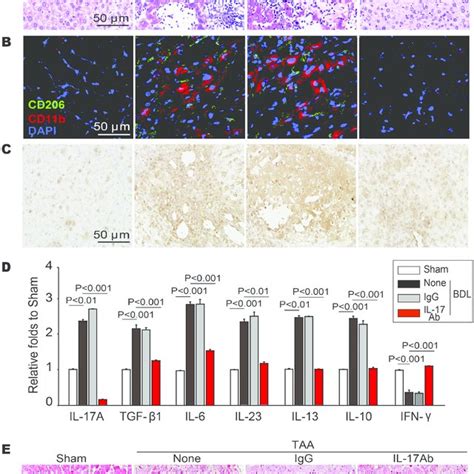 Neutralization Of Il 17a Resolved Bdl Or Taa Induced Acute Or Chronic