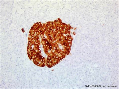 anti syp antibody sdix llc