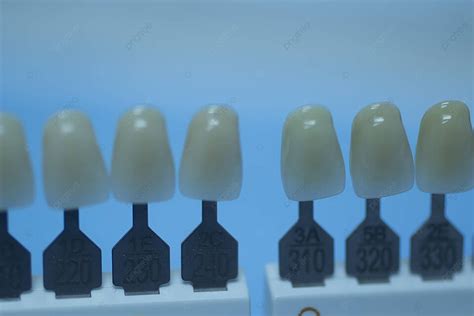 Comprehensive Guide To Dental Implant And Crown Colors For