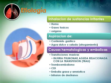 Sindrome De Dificultad Respiratoria Aguda PPT