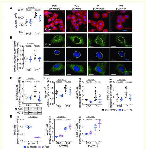 Lentiviral Overexpression Of H19 Blocks Cardiac Hypertrophy In Vitro