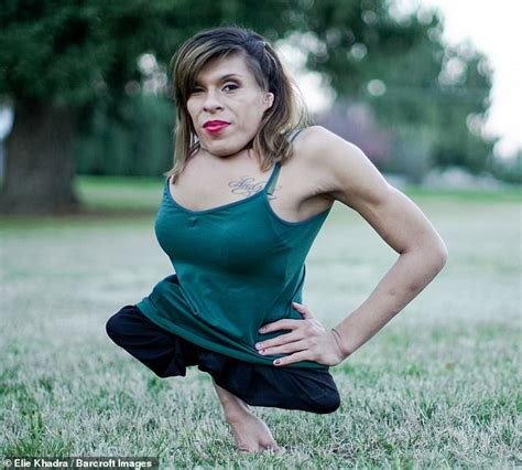 Transgender Woman Born With Half A Body Has A Wonderful Sex Life With