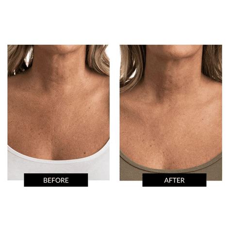 Currentbody Skin Face Neck Kit Nel