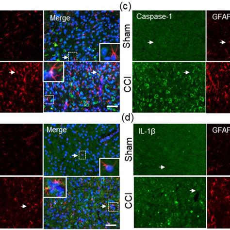 Cellular localization of TXNIP a NLRP3 b caspase 1 c and IL 1β