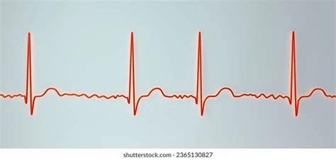 Ecg Atrial Fibrillation Afib 3d Illustration Stock Illustration 2365130827 | Shutterstock