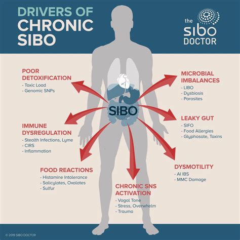 Sibo Sintomas E Tratamento Braincp