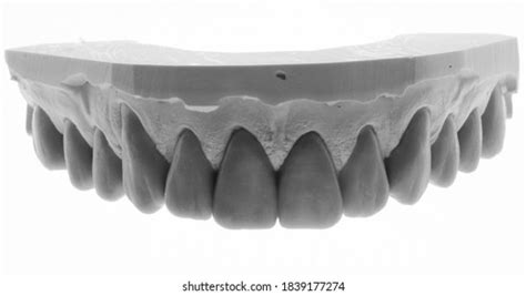 830 Dental wax up Images, Stock Photos & Vectors | Shutterstock