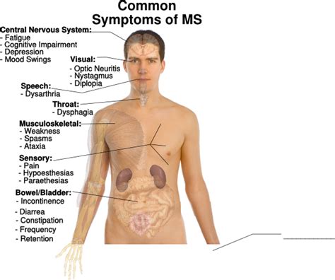 Common Symptoms Of Ms Clip Art at Clker.com - vector clip art online ...