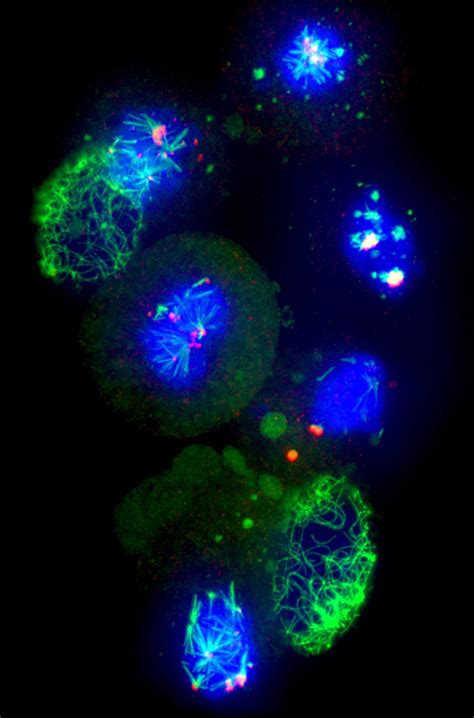 PhD course in Biophotonics – University of Southern Denmark - Turku Bioimaging