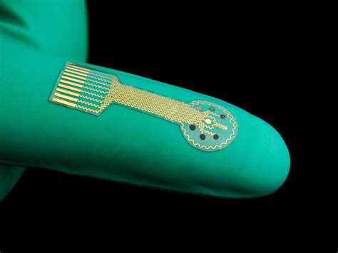 Smart Bandages Monitor Wounds And Provide Targeted Treatment