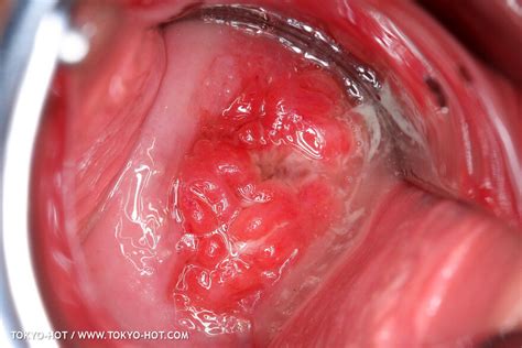 Tokyo Hot N0950 Set2 Mari Sato 1107 Porn Pic