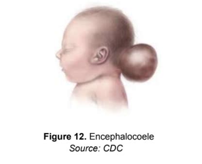 Neuroembryology Flashcards Quizlet