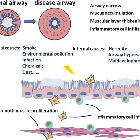 ASM Dysfunction Plays An Important Role In The Pathogenesis Of COPD