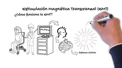 Estimulaci N Magn Tica Transcraneal Entrenamiento Cerebral