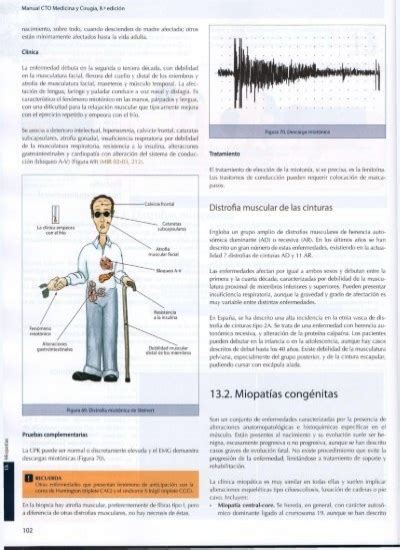 Illas Debido Al Reemplaz