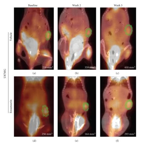 SUV in NOD/SCID mice implanted with U87MG. Representative mouse ...