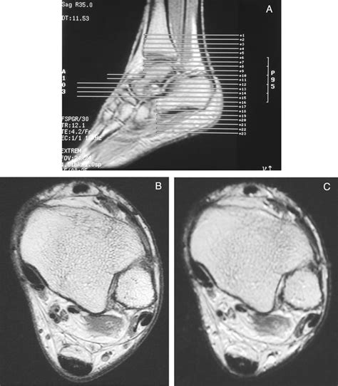 Figure A25.1.1 Transverse imaging plane. (A) Using the sagittal ...