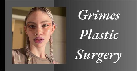 Grimes Plastic Surgery: The Truth About Her Transformative Beauty ...