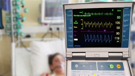 HD EKG/ECG Heart Monitor With Yellow Line - Even Pace Stock Footage ...