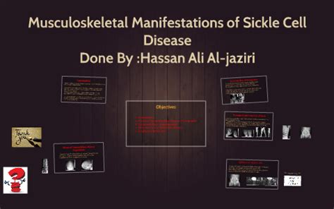 Musculoskeletal Manifestations Of Sickle Cell Disease By Hassan Ali